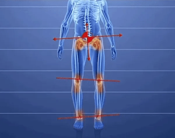 RELOOG | Recomendado por médicos | Soporte de arco | Doble comodidad 👞